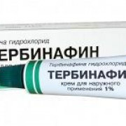 small-terbinafin-krem-d/naruzhn-pr-1-15g-n1-tuba-pk-0